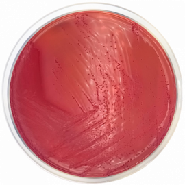 Yersinia Selective Agar Base (CIN) ISO