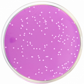 Rose Bengal Agar + Chloramphenicol + Dichloran (DRBC Agar) ISO