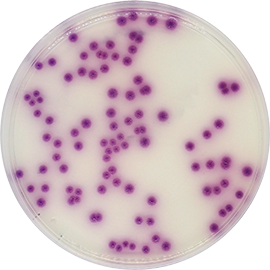 Salmonella Chromogenic Agar