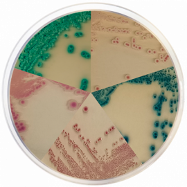 Agar Cromogénico Cándida