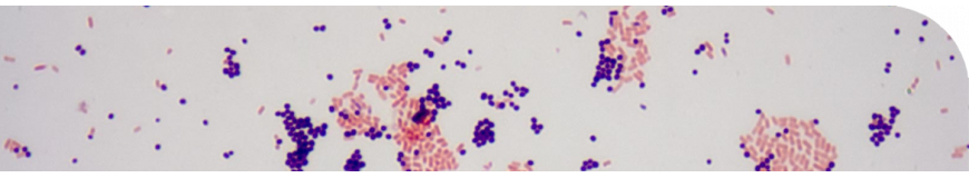 Identification stains and dyes in Condalab