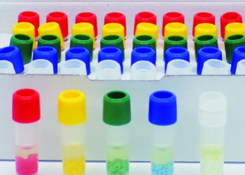 New solution in Condalab: Cryopreserve Beads