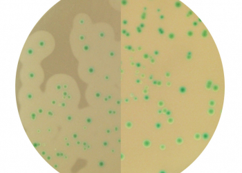 When in doubt, CondaChrome Listeria®