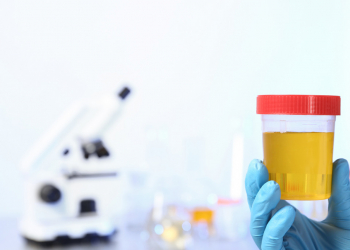 Chromogenics for the rapid diagnosis of uropathogens 